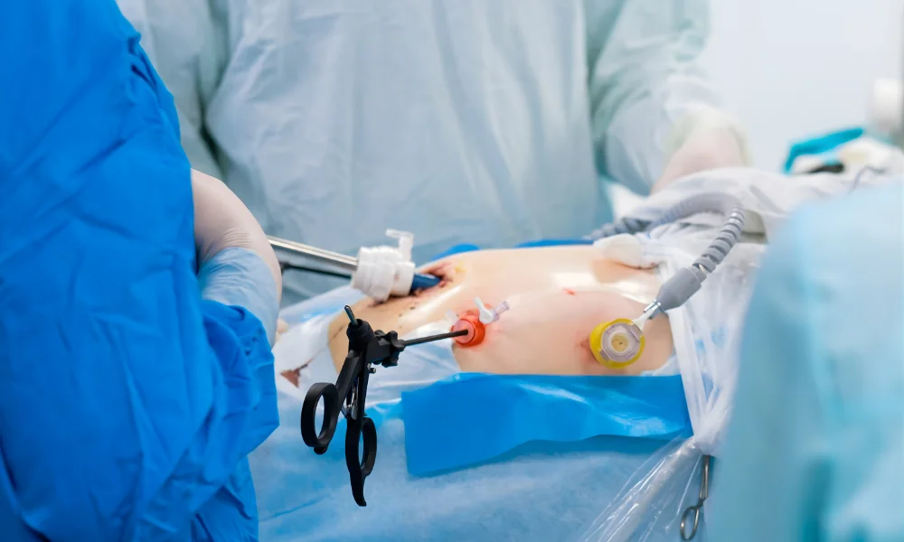 Best Minimally Invasive Gynecological Surgeries – Dr. Prodduturu Padmaja 
